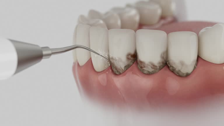 Reliable Emergency Dentist contractor in McLean County County, ND by Dentist Open Now